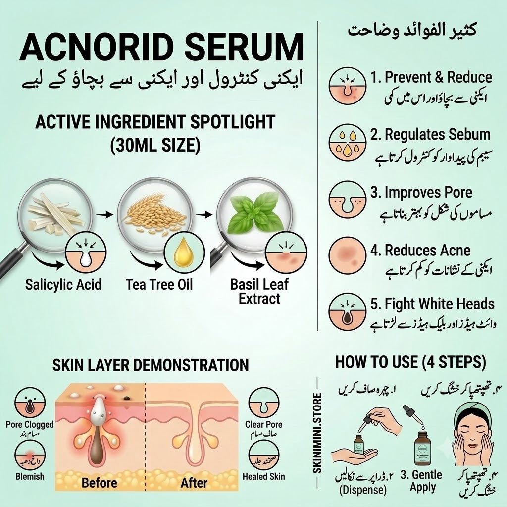 ACNORID ANTI ACNE SERUM 30ML FOR ACNE PROTECTION